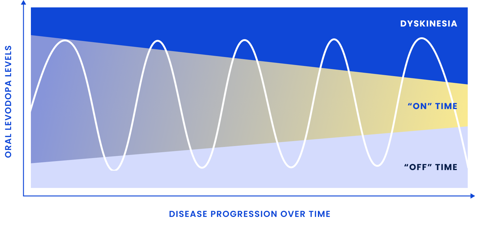Dyskinesia and "off" time become more common as Parkinson's disease progresses and the therapeutic window narrows.